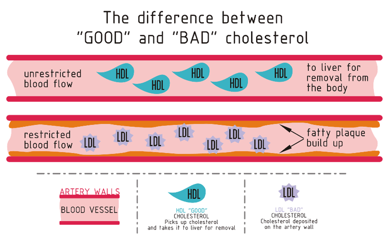 Cholesterol Types - Cholesterol Blood