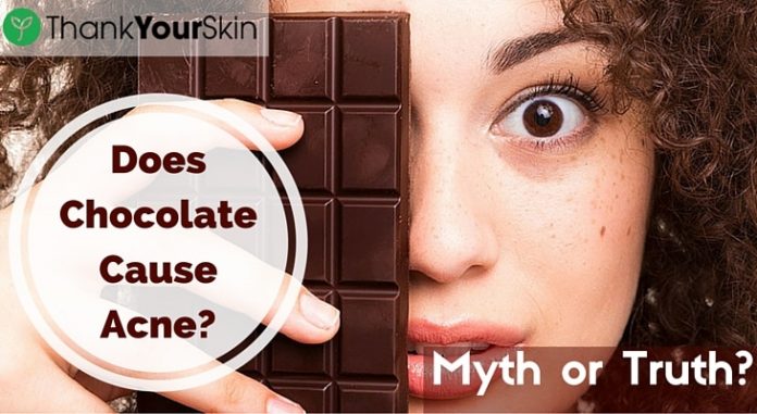 Why do Chocolate Stimulate Acne?